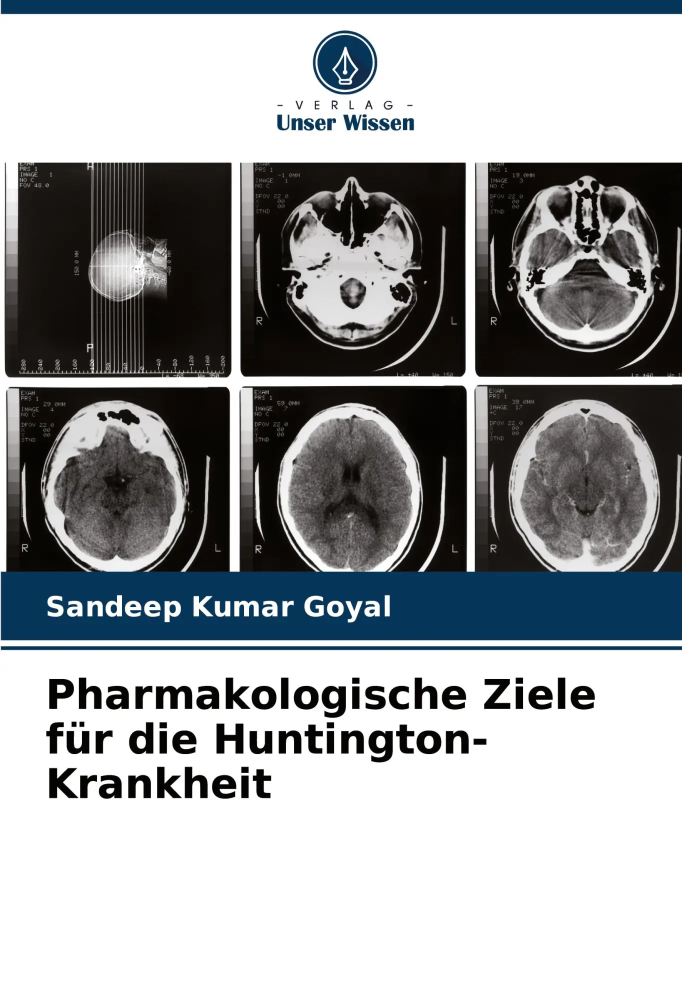 Cover: 9786206897637 | Pharmakologische Ziele für die Huntington-Krankheit | Goyal | Buch