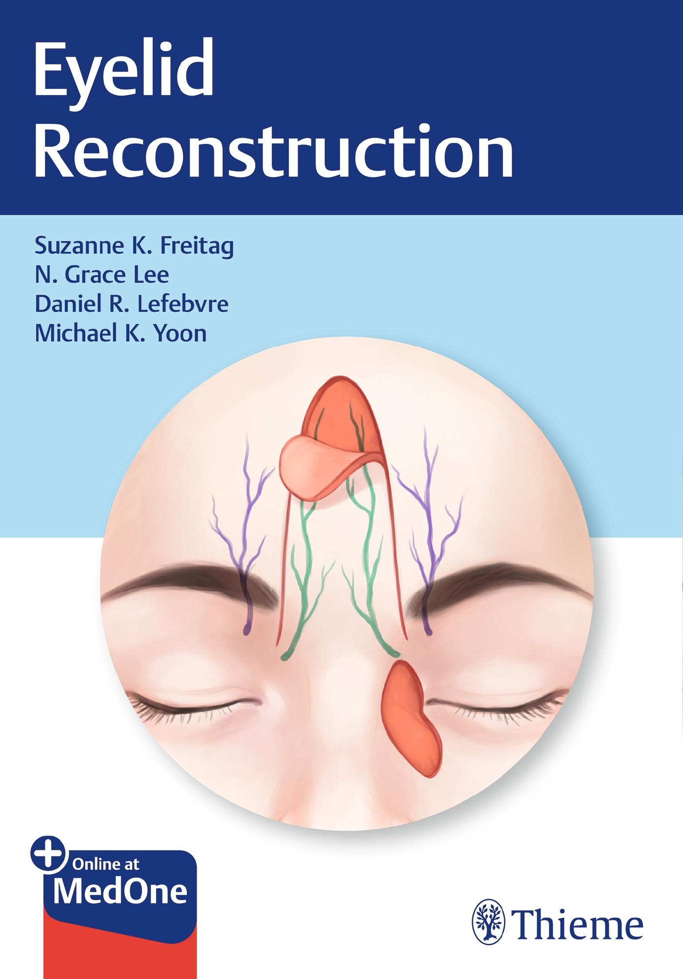 Cover: 9781626238237 | Eyelid Reconstruction | Suzanne K Freitag (u. a.) | Buch | Englisch