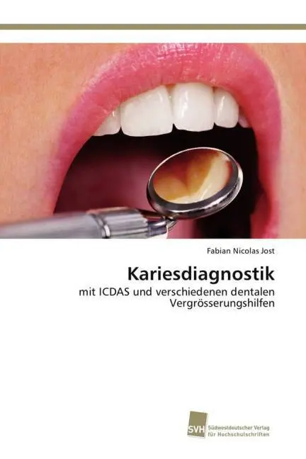 Cover: 9783838150338 | Kariesdiagnostik | Fabian Nicolas Jost | Taschenbuch | Paperback