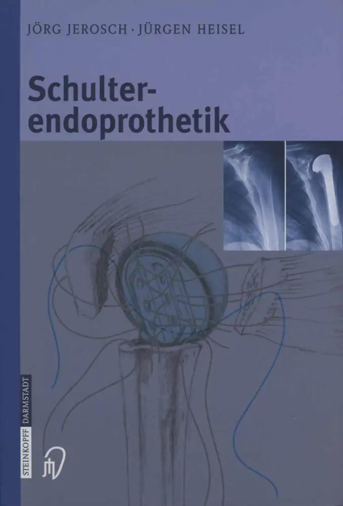 Cover: 9783642632938 | Schulterendoprothetik | Jörg Jerosch (u. a.) | Taschenbuch | xii