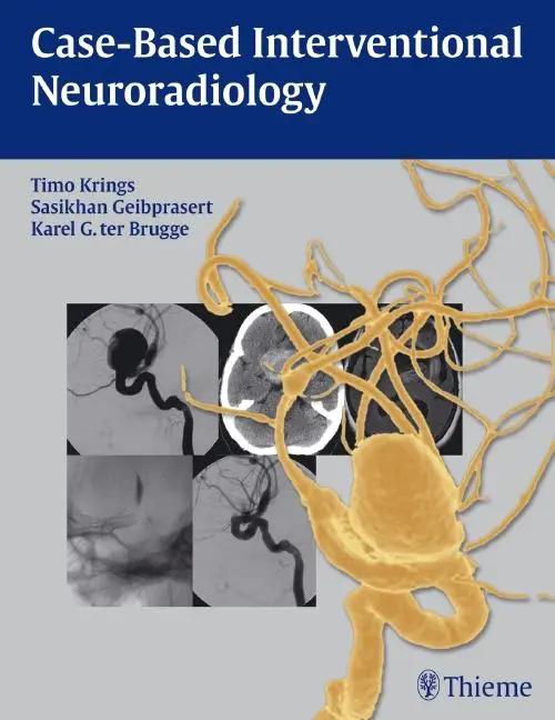 Cover: 9781604063738 | Case-Based Interventional Neuroradiology | Timo Krings (u. a.) | Buch