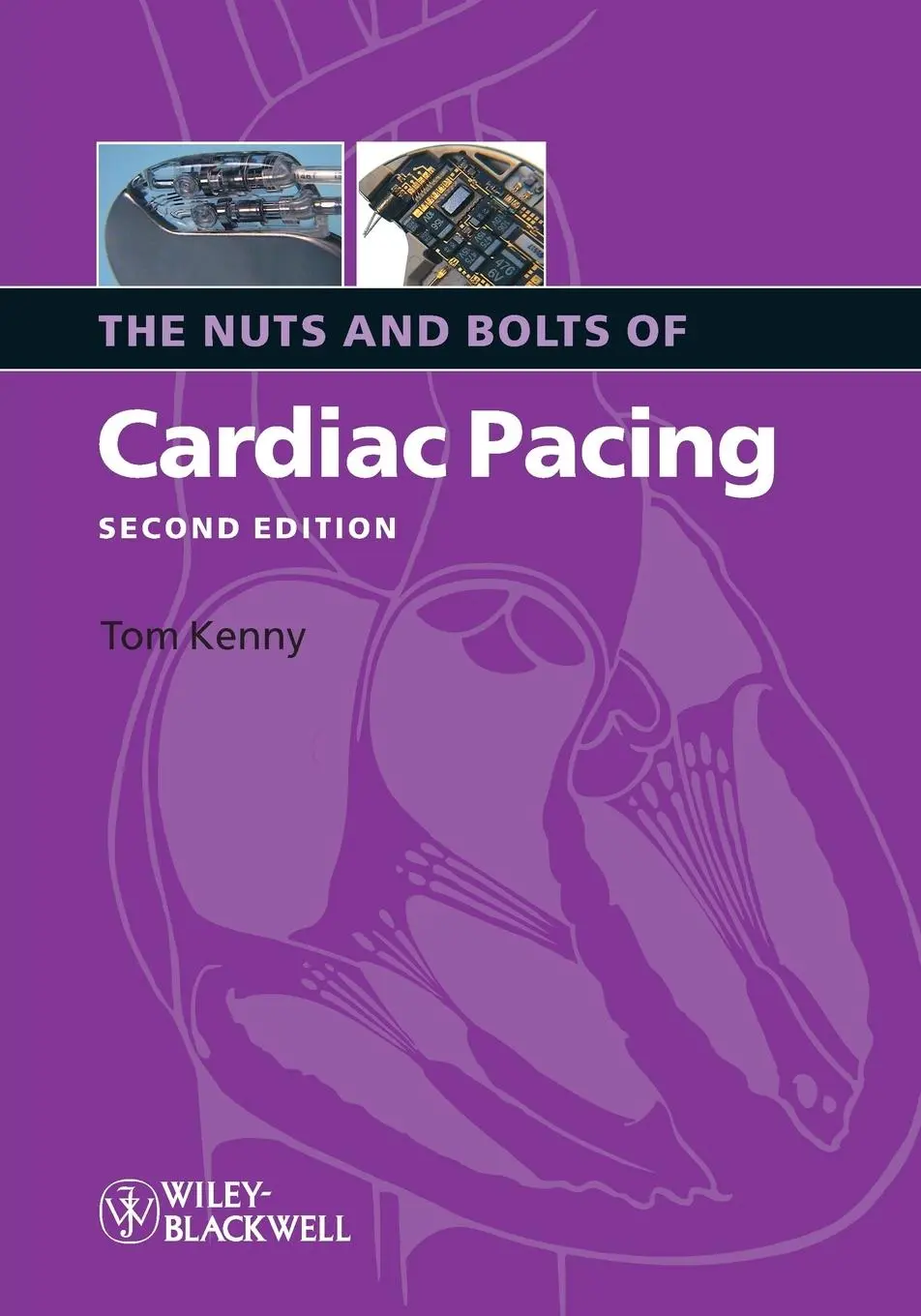 Cover: 9781405184038 | Nuts Bolts Cardiac Pacing 2e | Tom Kenny | Taschenbuch | 180 S. | 2008