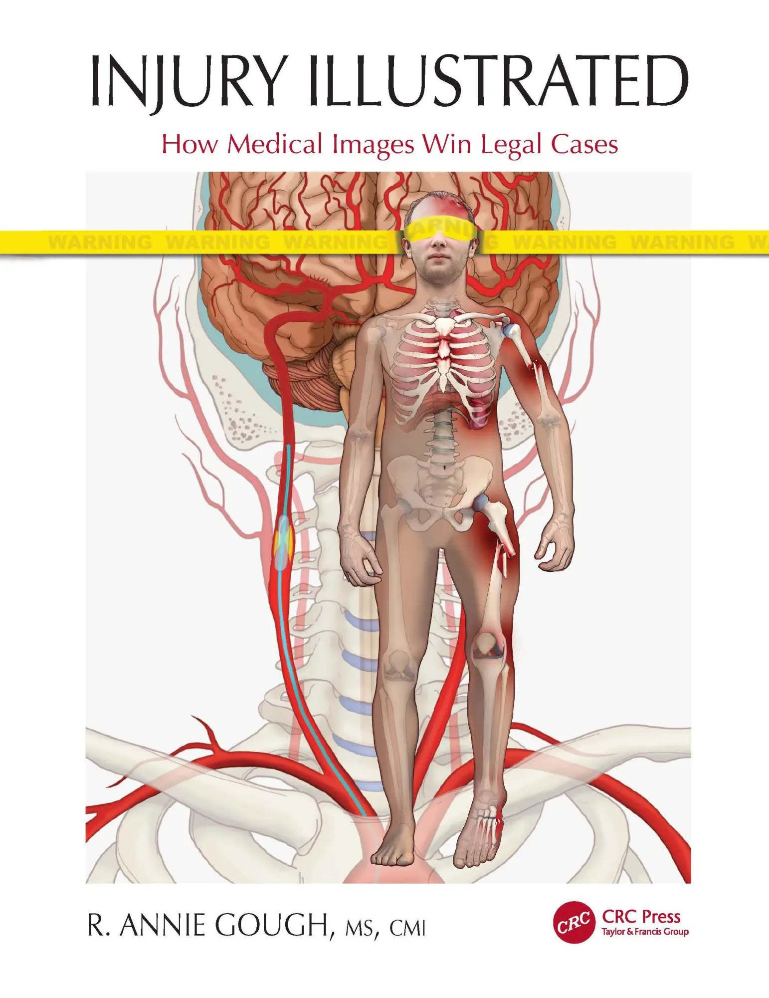 Cover: 9780367615338 | Injury Illustrated | How Medical Images Win Legal Cases | Gough | Buch