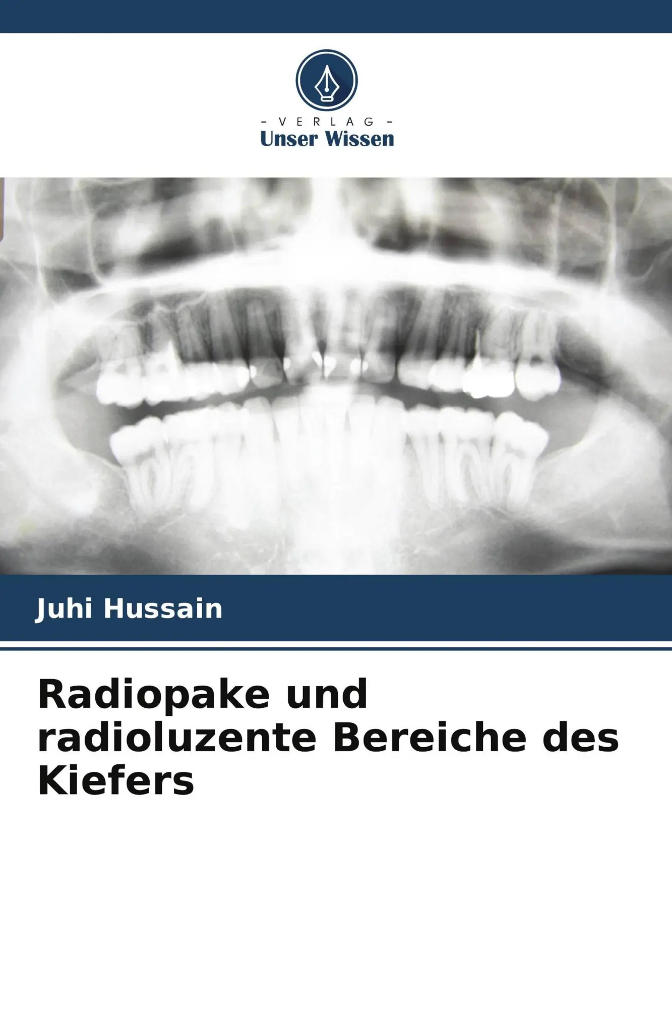 Cover: 9786209515538 | Radiopake und radioluzente Bereiche des Kiefers | Juhi Hussain | Buch