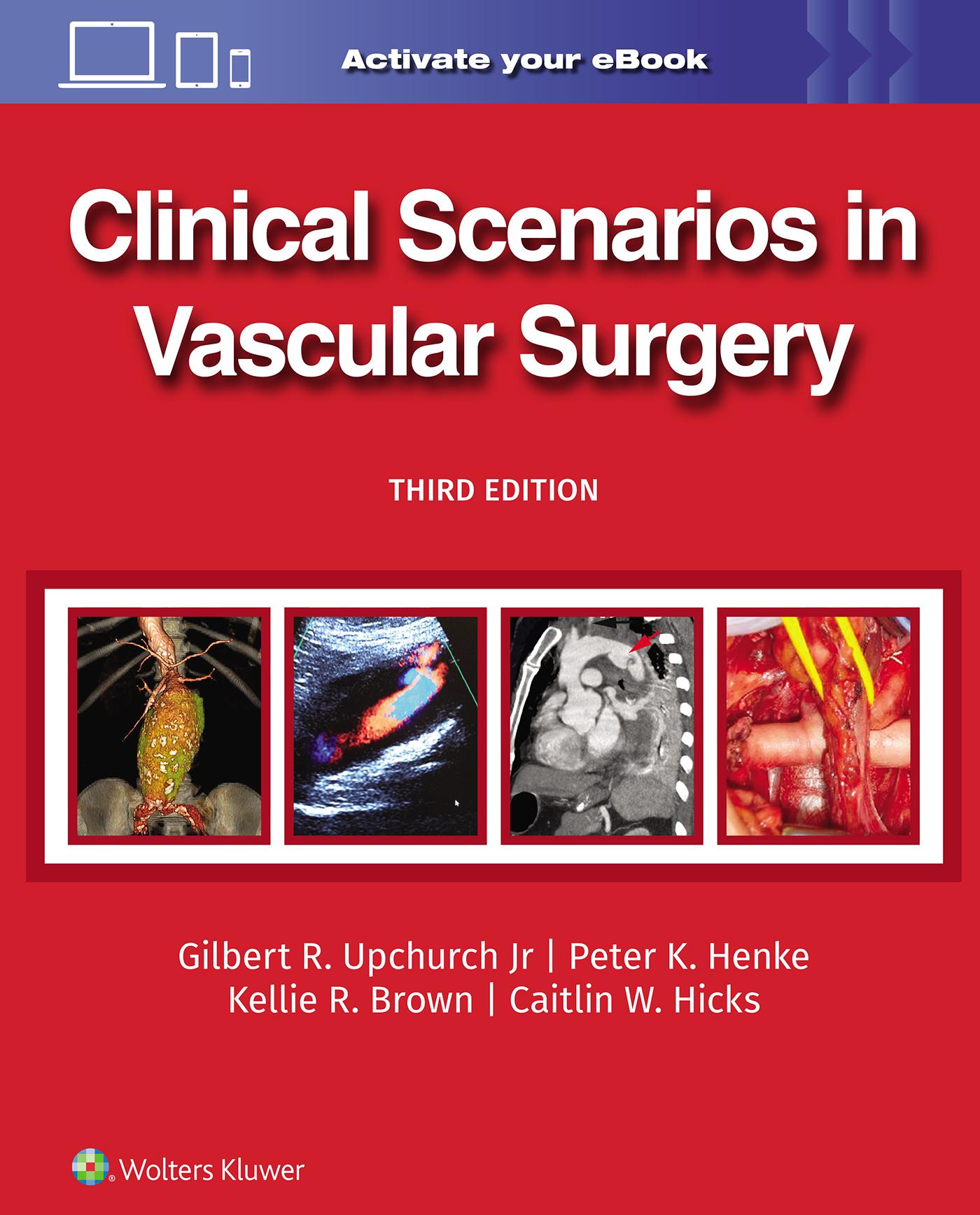 Cover: 9781975216238 | Clinical Scenarios in Vascular Surgery | Gilbert R. Upchurch (u. a.)