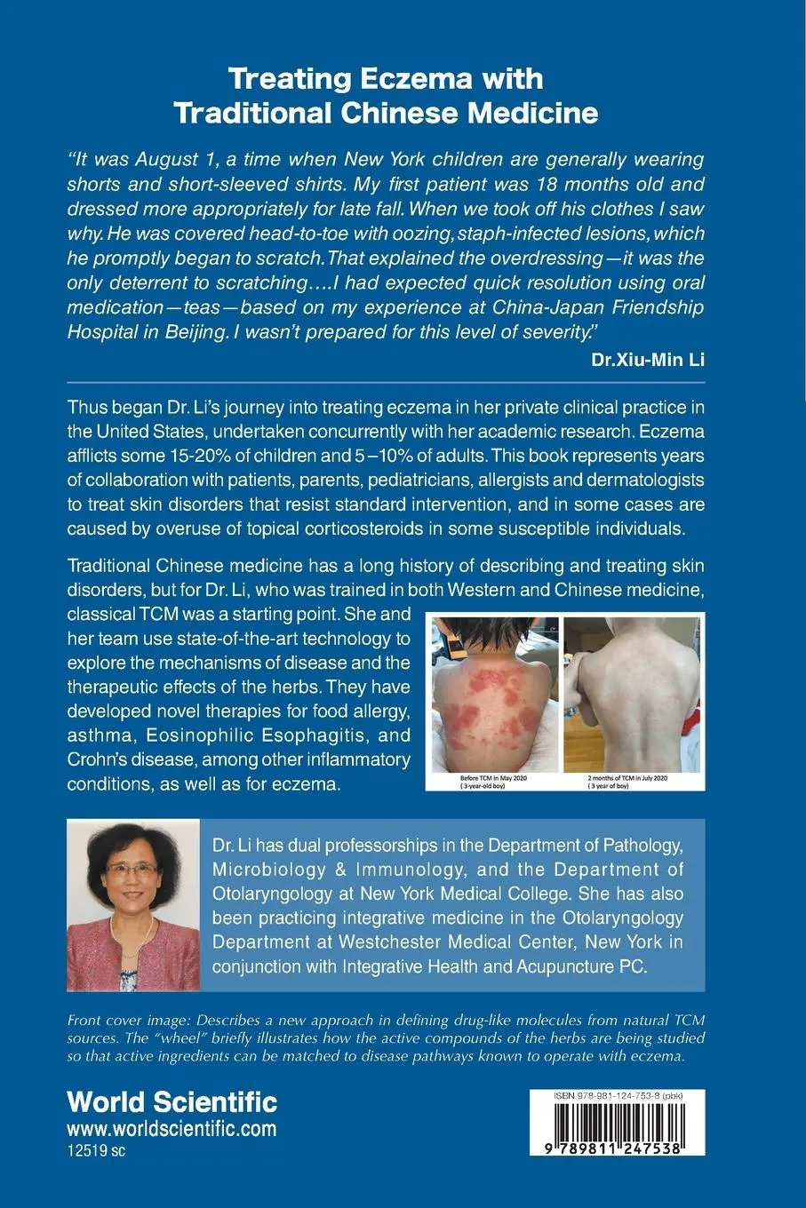 Rückseite: 9789811247538 | Treating Eczema With Traditional Chinese Medicine | Li (u. a.) | Buch
