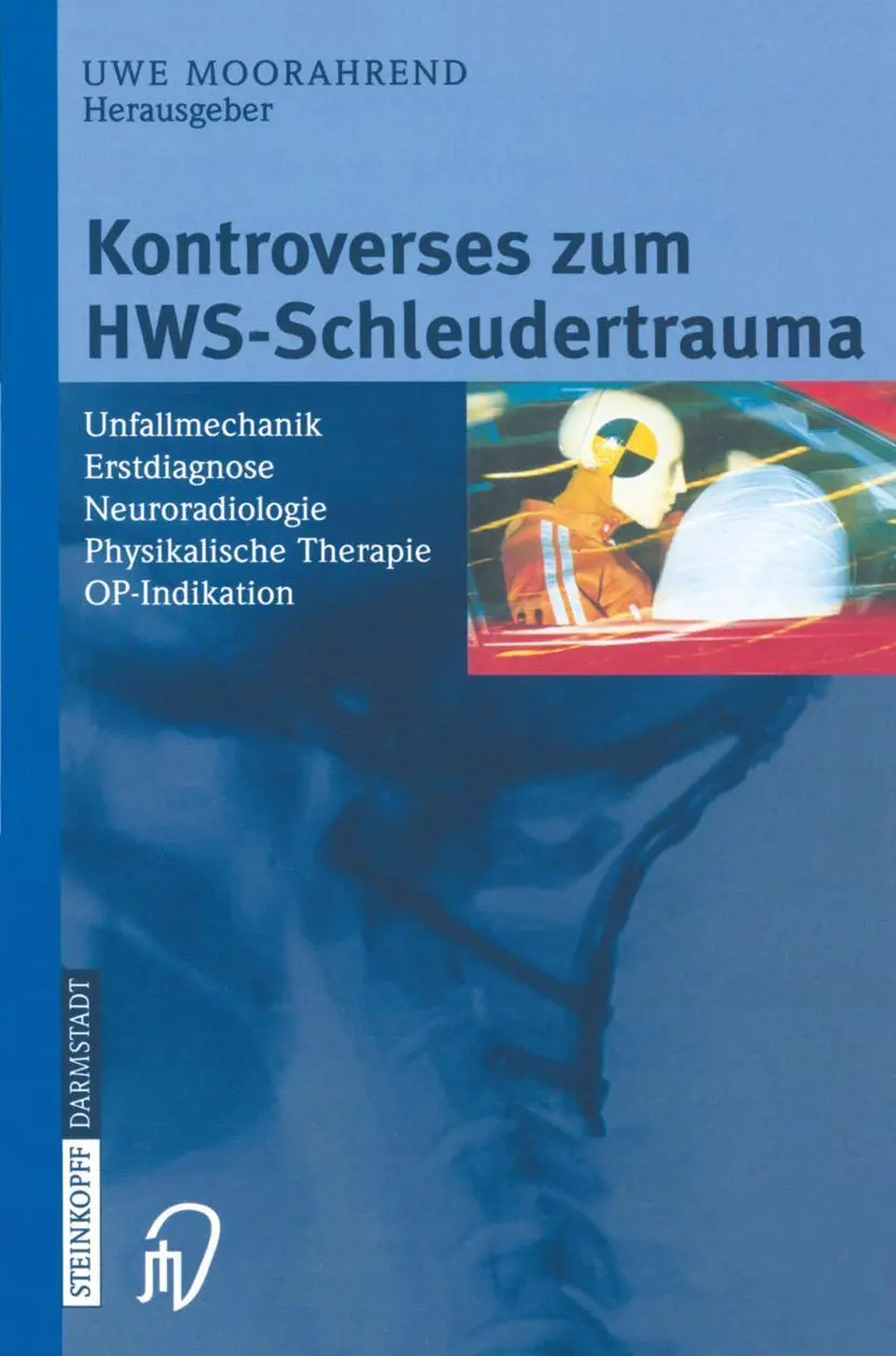 Cover: 9783798513839 | Kontroverses zum HWS-Schleudertrauma | U. Moorahrend | Taschenbuch | x