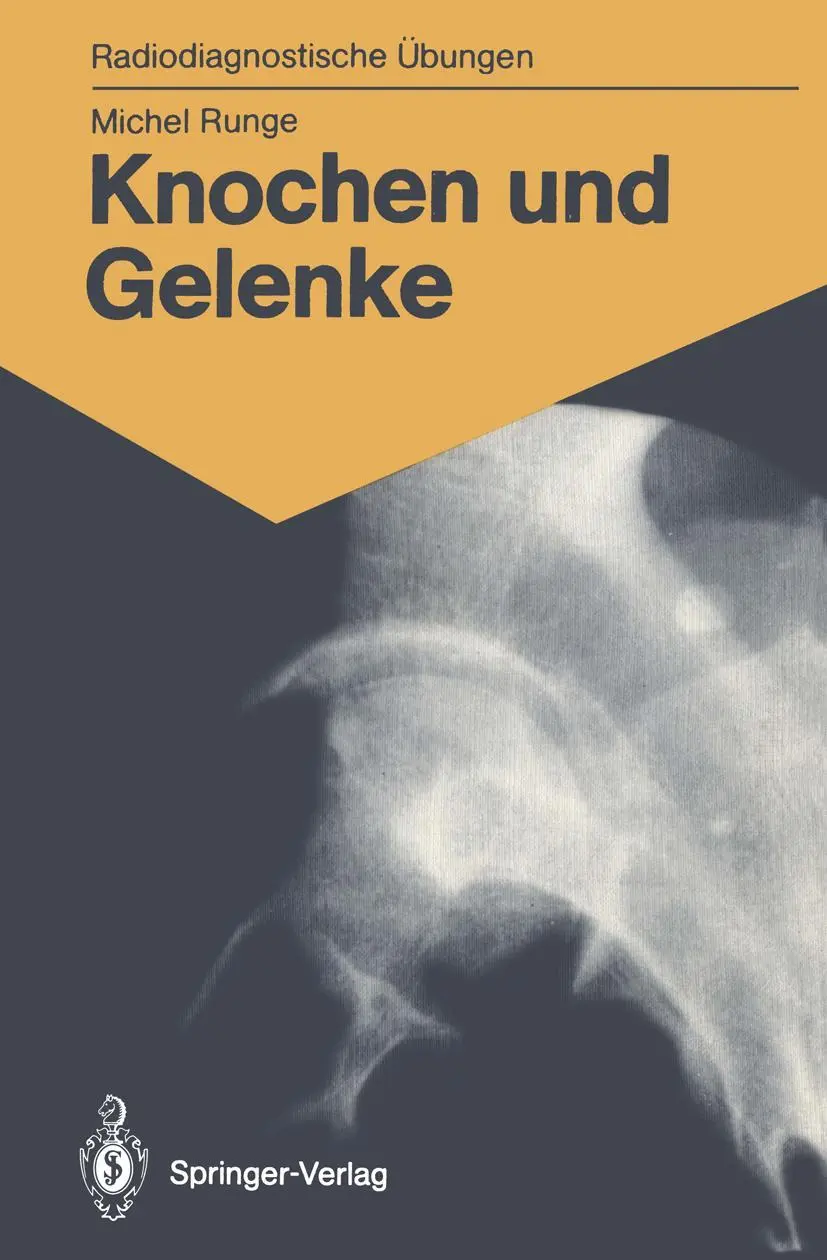 Cover: 9783540165439 | Knochen und Gelenke | Michel Runge | Taschenbuch | vii | Deutsch