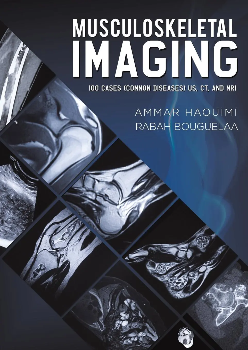 Cover: 9781528946339 | Musculoskeletal Imaging | 100 Cases (Common Diseases) US, CT and MRI
