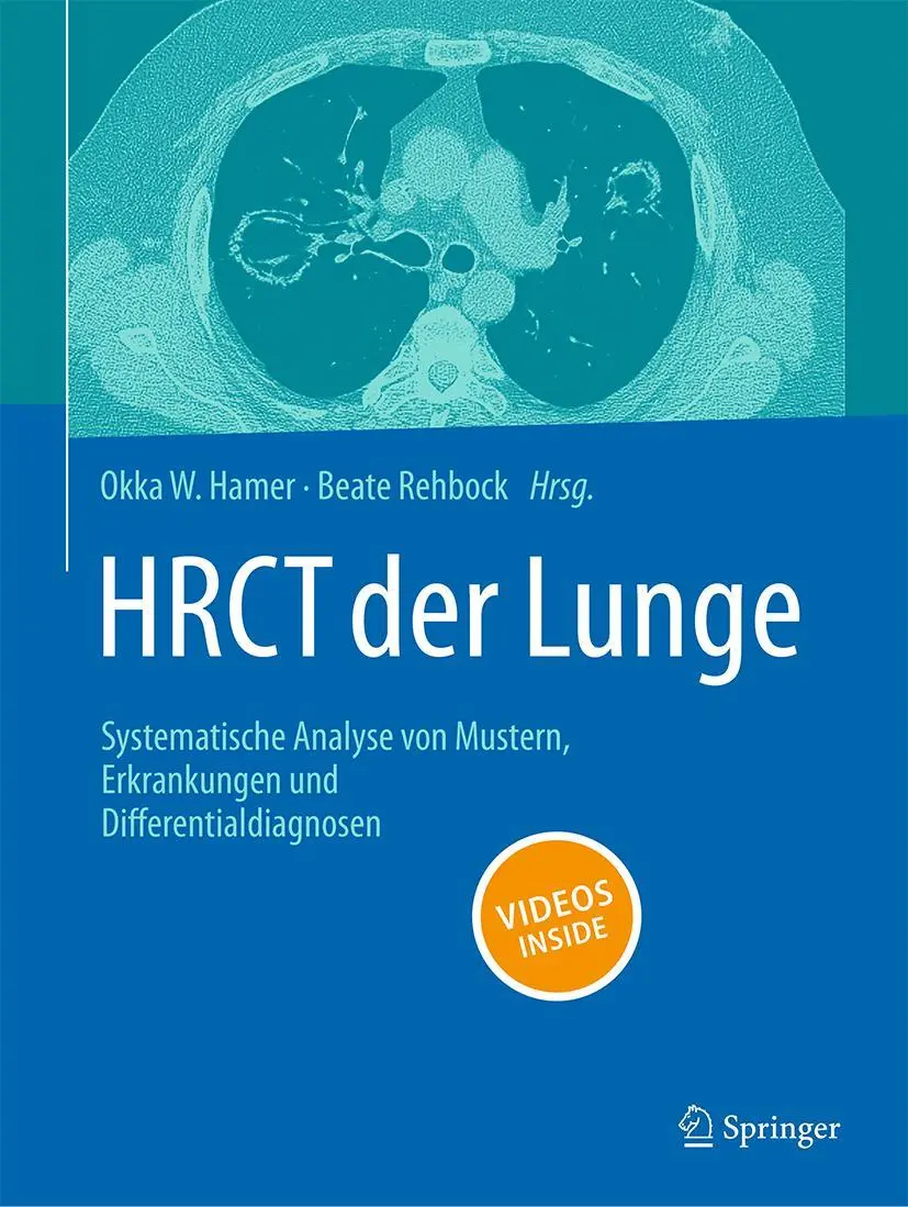 Cover: 9783662647639 | HRCT der Lunge | Okka W. Hamer (u. a.) | Buch | xiii | Deutsch | 2025