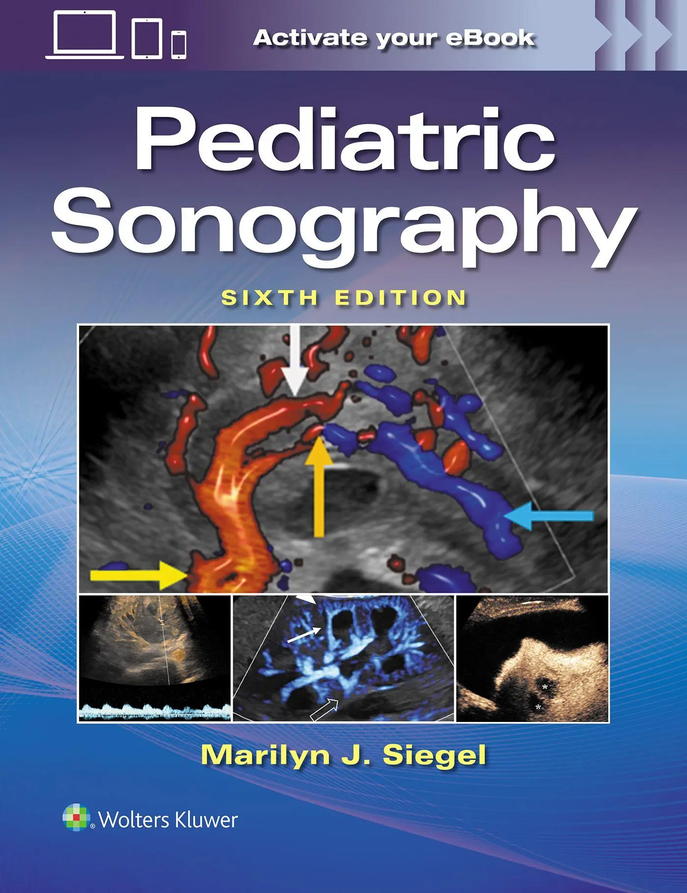 Cover: 9781975248239 | Pediatric Sonography | Marilyn Joy Siegel | Taschenbuch | Englisch