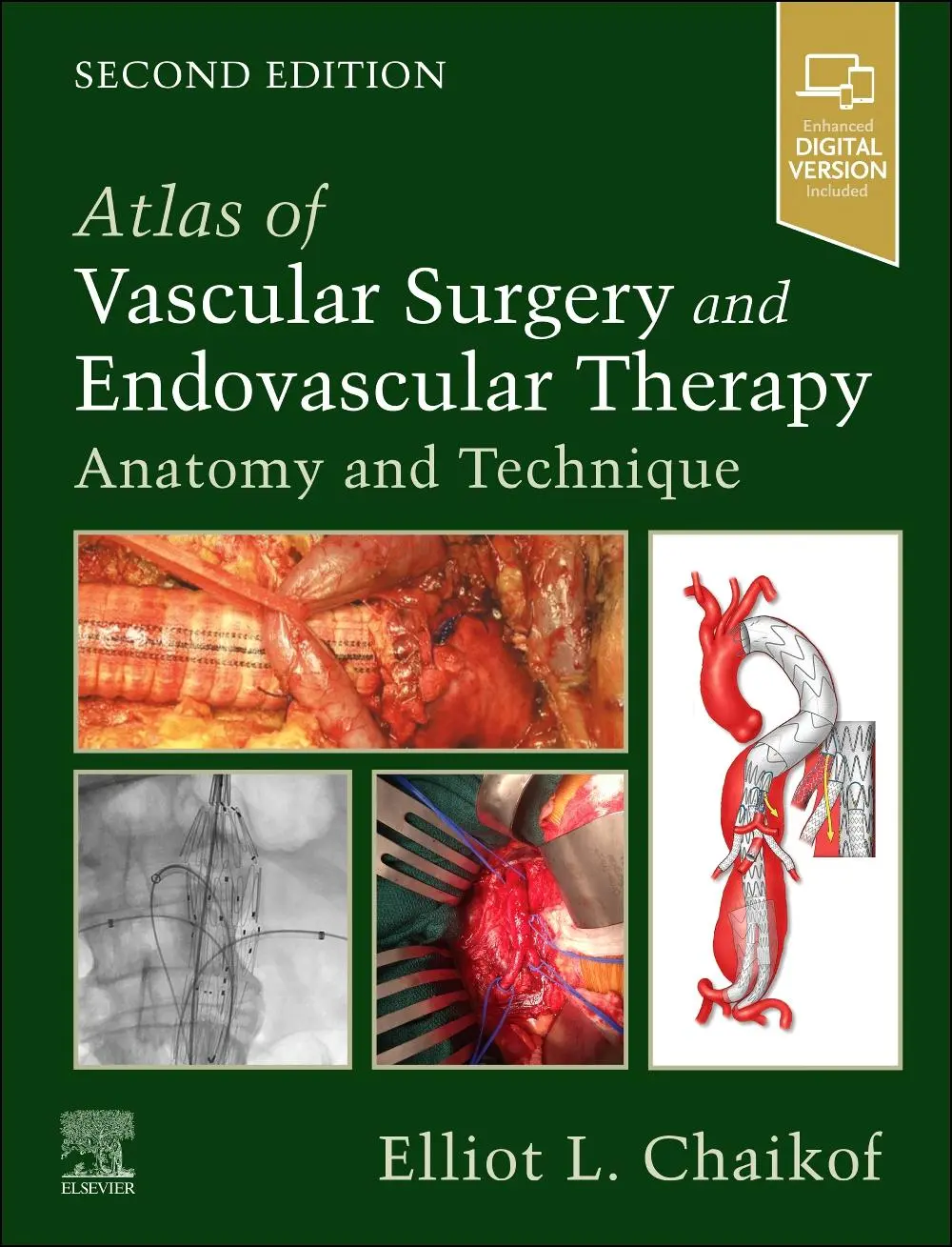 Cover: 9780323566940 | Atlas of Vascular Surgery and Endovascular Therapy | Elliot L Chaikof