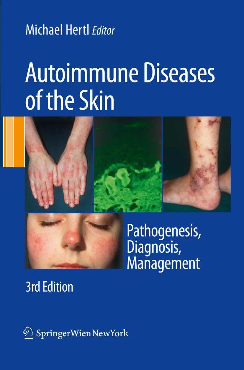 Cover: 9783211992241 | Autoimmune Diseases of the Skin | Pathogenesis, Diagnosis, Management