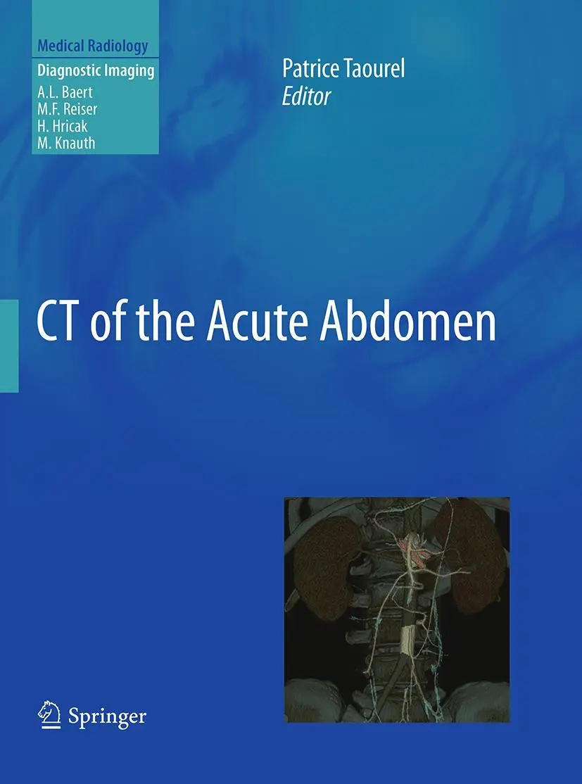 Cover: 9783662502341 | CT of the Acute Abdomen | Patrice Taourel | Taschenbuch | ix | 2016