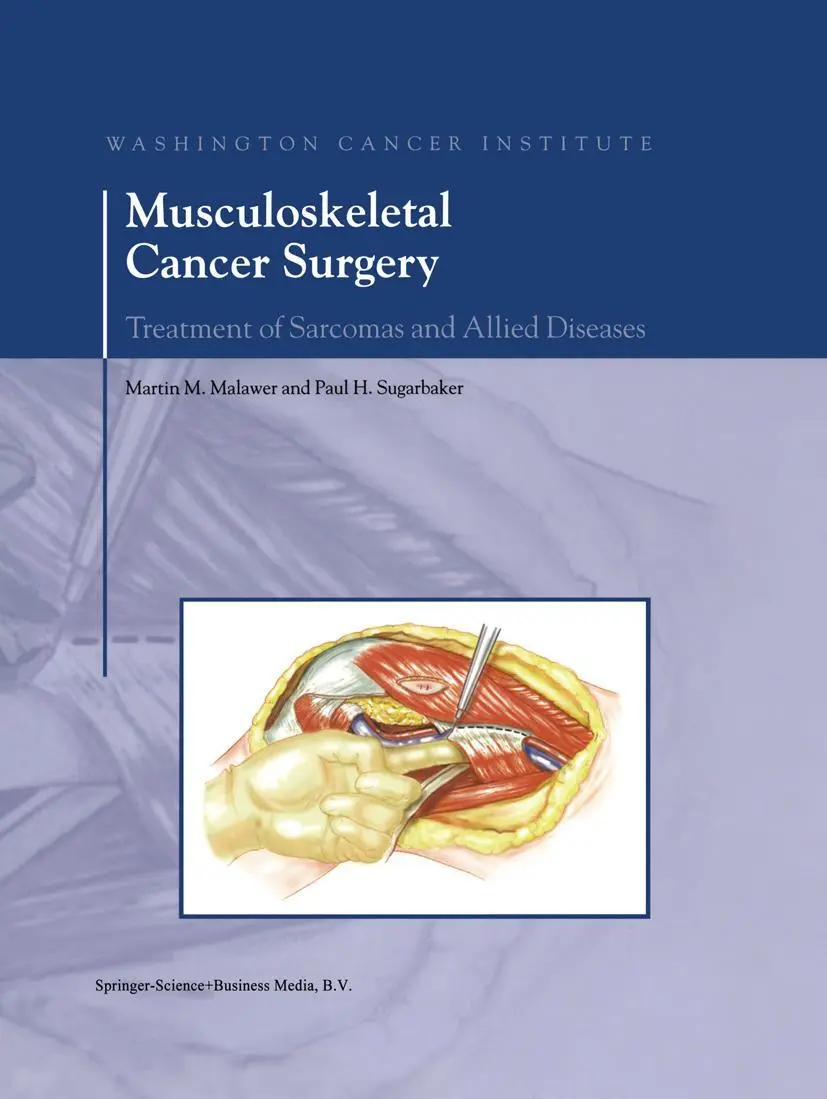 Cover: 9780792363941 | Musculoskeletal Cancer Surgery | Paul H. Sugarbaker (u. a.) | Buch