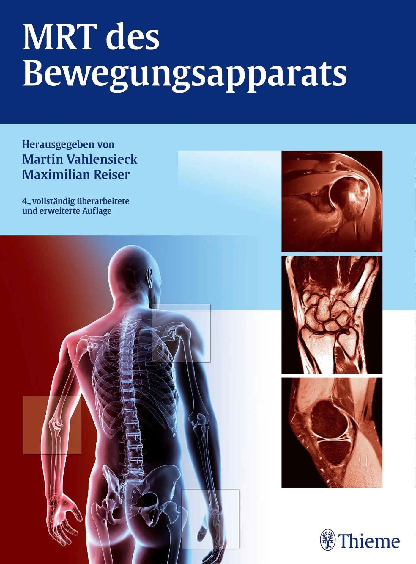 Cover: 9783131036841 | MRT des Bewegungsapparats | Martin Vahlensieck (u. a.) | Buch | 738 S.