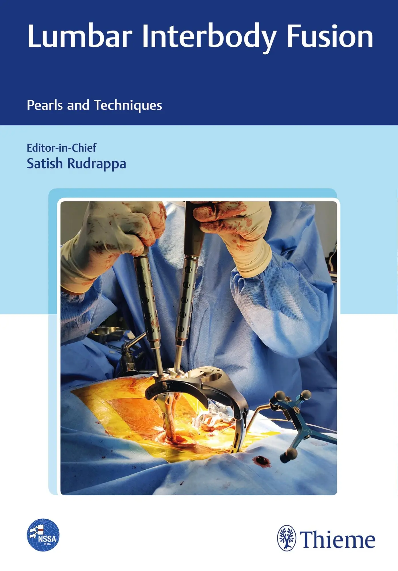 Lumbar Interbody Fusion Gebunden