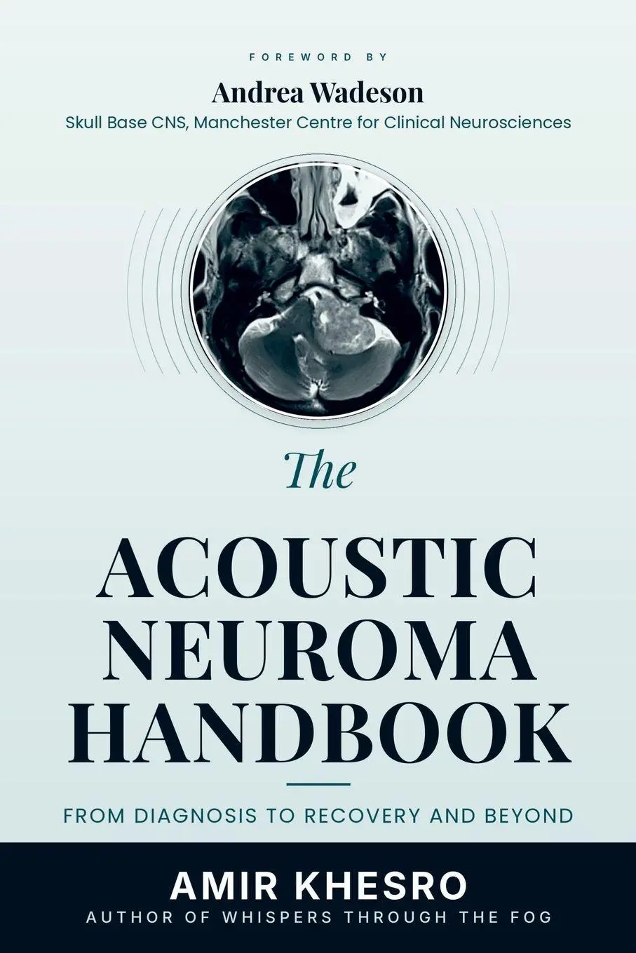 Cover: 9781066798841 | THE ACOUSTIC NEUROMA (VESTIBULAR SCHWANNOMA) HANDBOOK | Amir Khesro