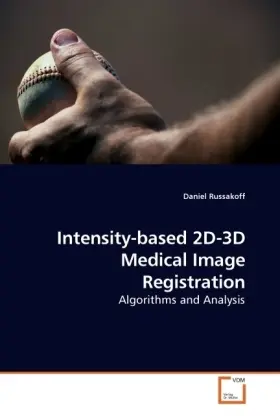Cover: 9783639119541 | Intensity-based 2D-3D Medical Image Registration | Daniel Russakoff