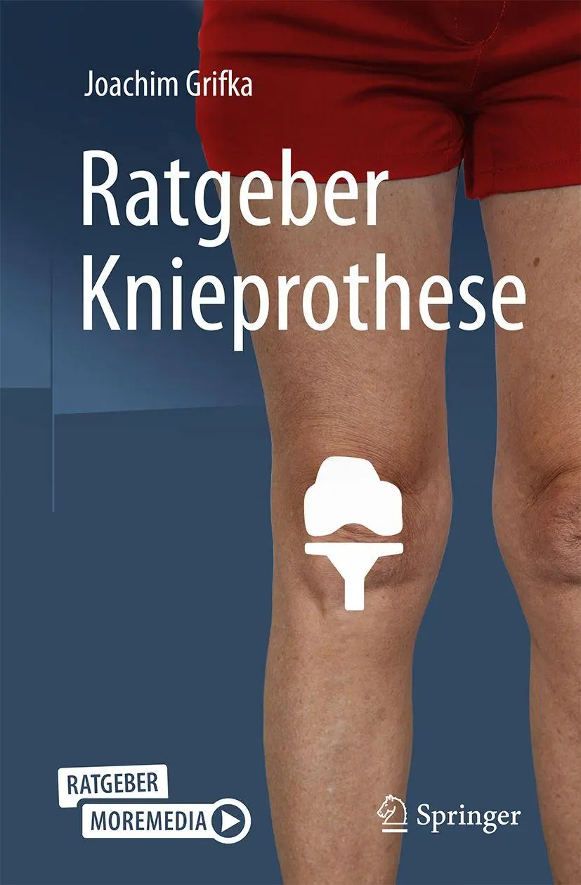 Cover: 9783662740842 | Ratgeber Knieprothese | Joachim Grifka | Taschenbuch | xii | Deutsch