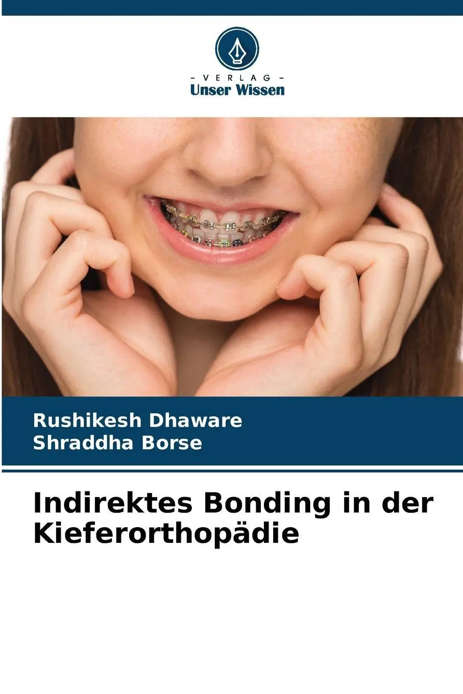 Cover: 9786209382642 | Indirektes Bonding in der Kieferorthopädie | Rushikesh Dhaware (u. a.)