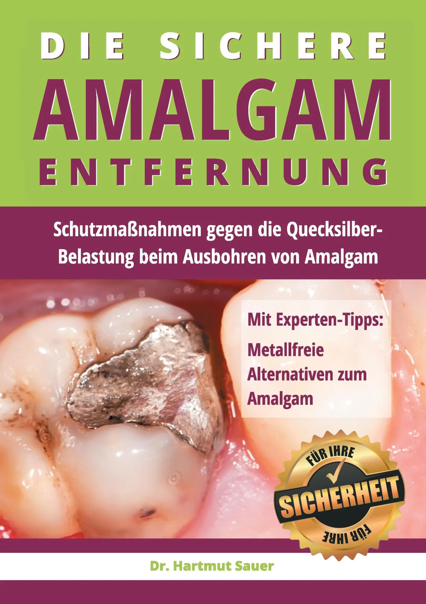 Cover: 9783735763242 | Die sichere Amalgam-Entfernung | Hartmut Sauer | Taschenbuch | 116 S.