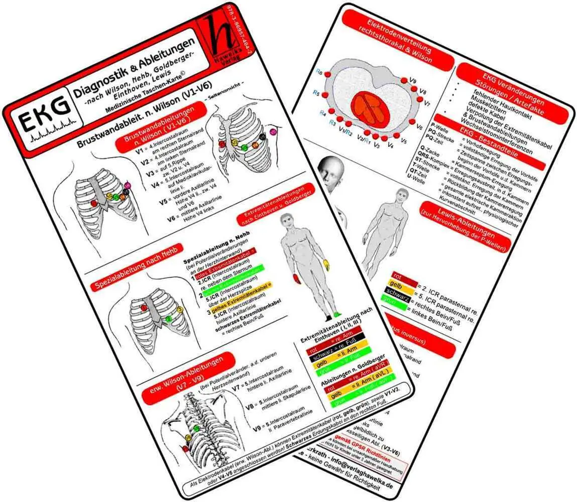 Cover: 9783869574042 | EKG Diagnostik &amp; Ableitungen - Medizinische Taschen-Karte | Verlag