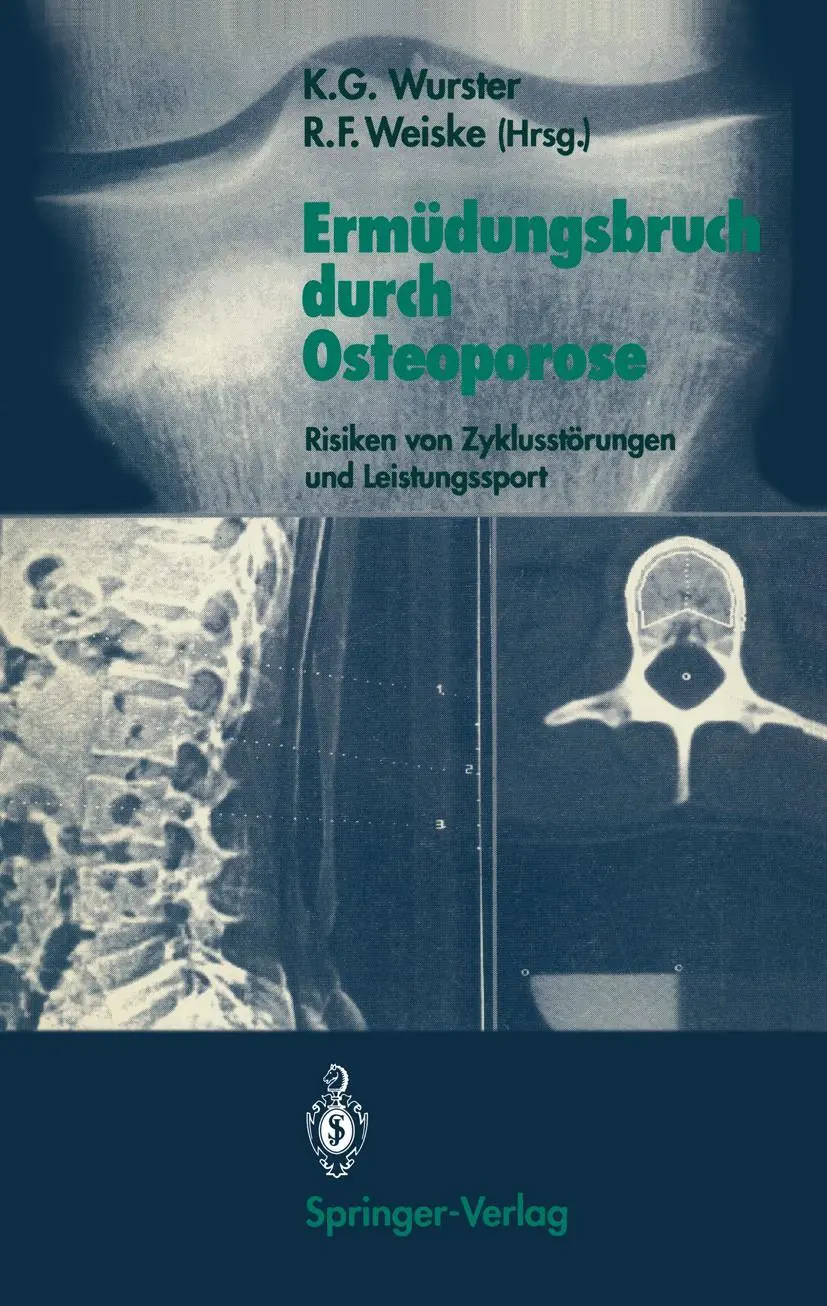Cover: 9783540514442 | Ermüdungsbruch durch Osteoporose | Roman F. Weiske (u. a.) | Buch