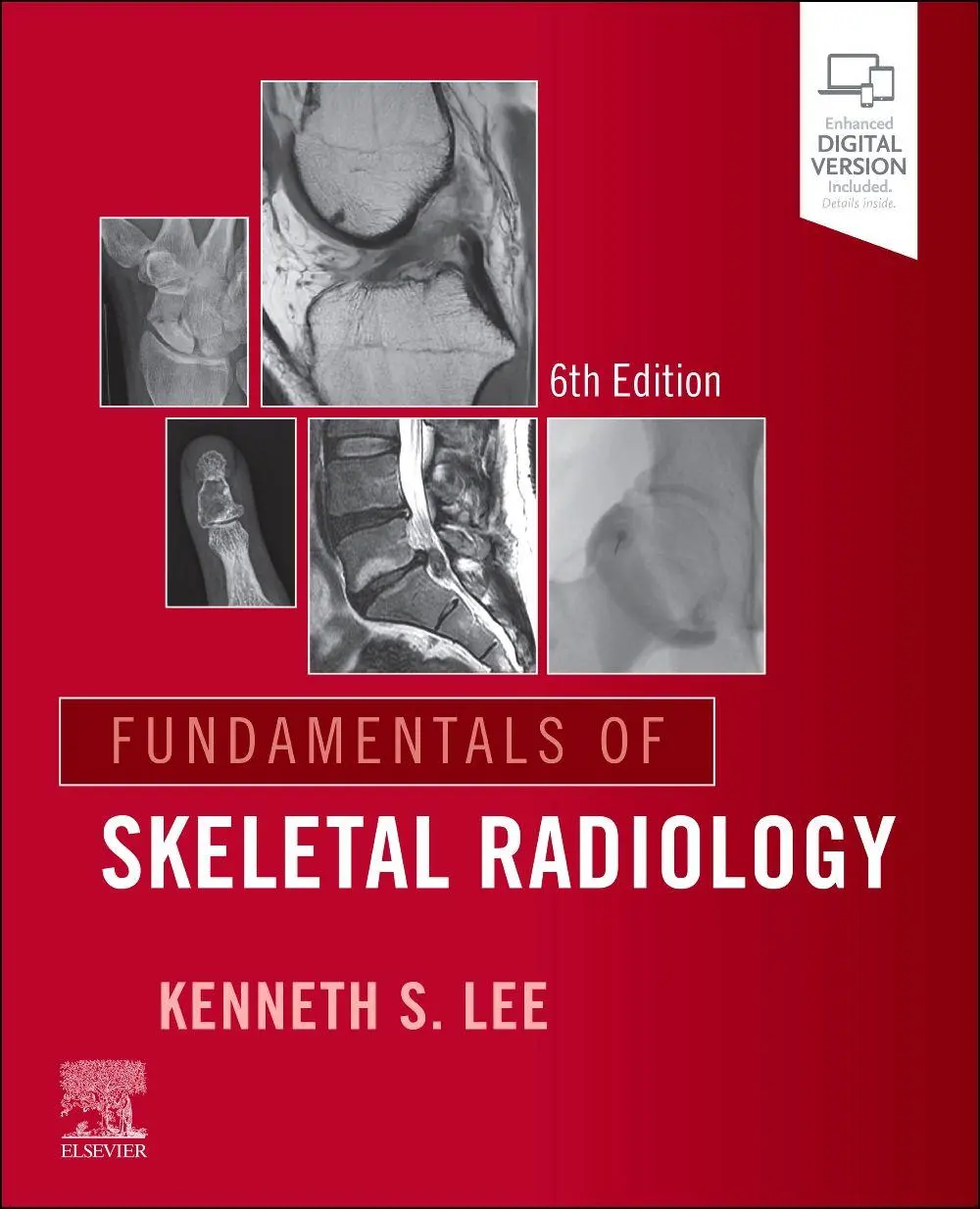 Cover: 9780443264542 | Fundamentals of Skeletal Radiology | Kenneth S Lee | Taschenbuch
