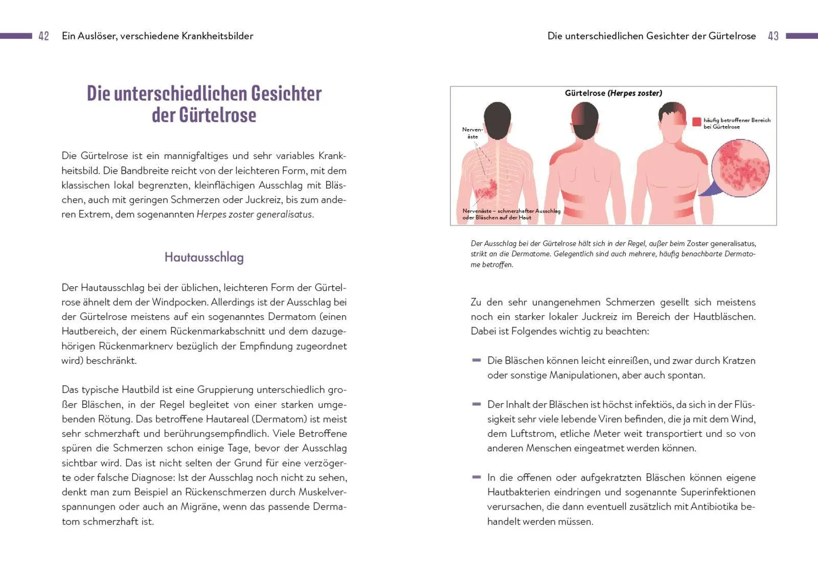 Bild: 9783742328342 | Gürtelrose | Georg Friese | Taschenbuch | 144 S. | Deutsch | 2025