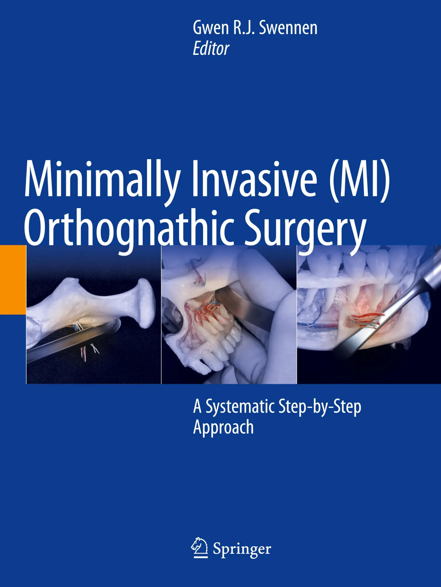 Cover: 9783031380143 | Minimally Invasive (MI) Orthognathic Surgery | Gwen R. J. Swennen