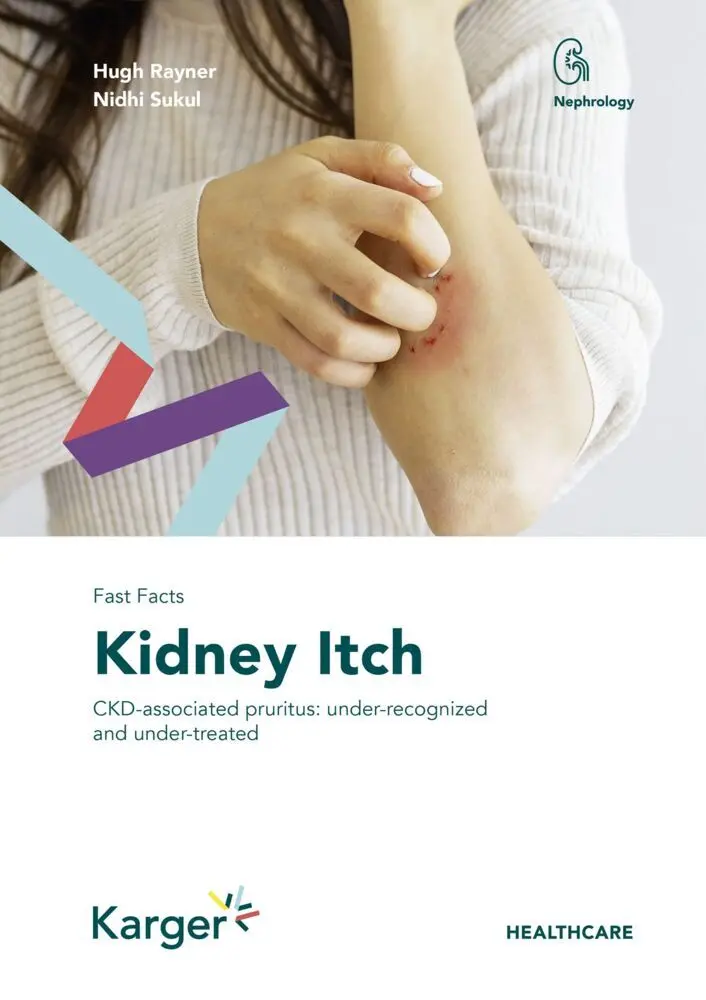 Cover: 9783318070743 | Fast Facts: Kidney Itch | Hugh Rayner (u. a.) | Taschenbuch | Englisch
