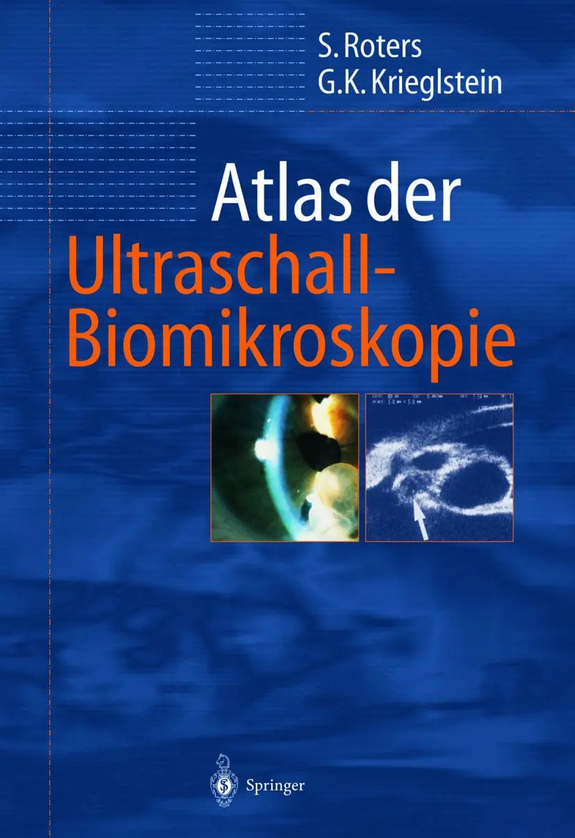 Cover: 9783642631443 | Atlas der Ultraschall-Biomikroskopie | Günter K. Krieglstein (u. a.)