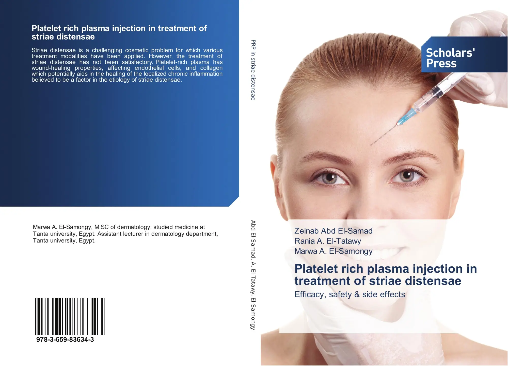 Cover: 9783659836343 | Platelet rich plasma injection in treatment of striae distensae | Buch