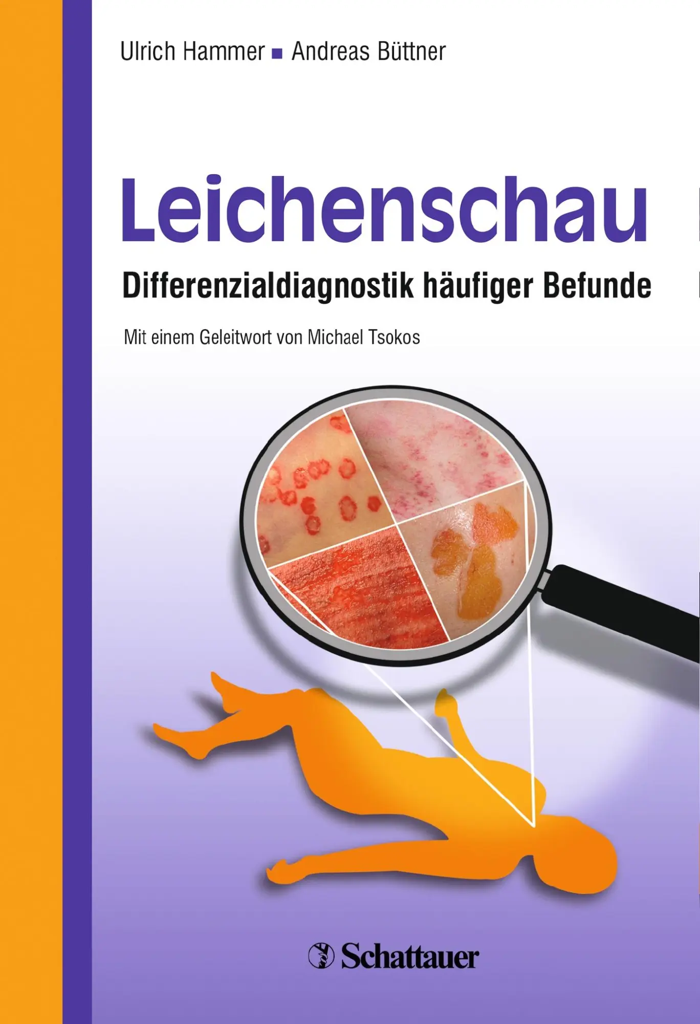 Cover: 9783794529643 | Leichenschau | Differenzialdiagnostik häufiger Befunde | Buch | XI