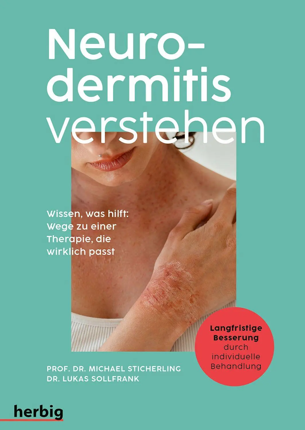 Cover: 9783968590844 | Neurodermitis verstehen | Michael Sticherling (u. a.) | Taschenbuch