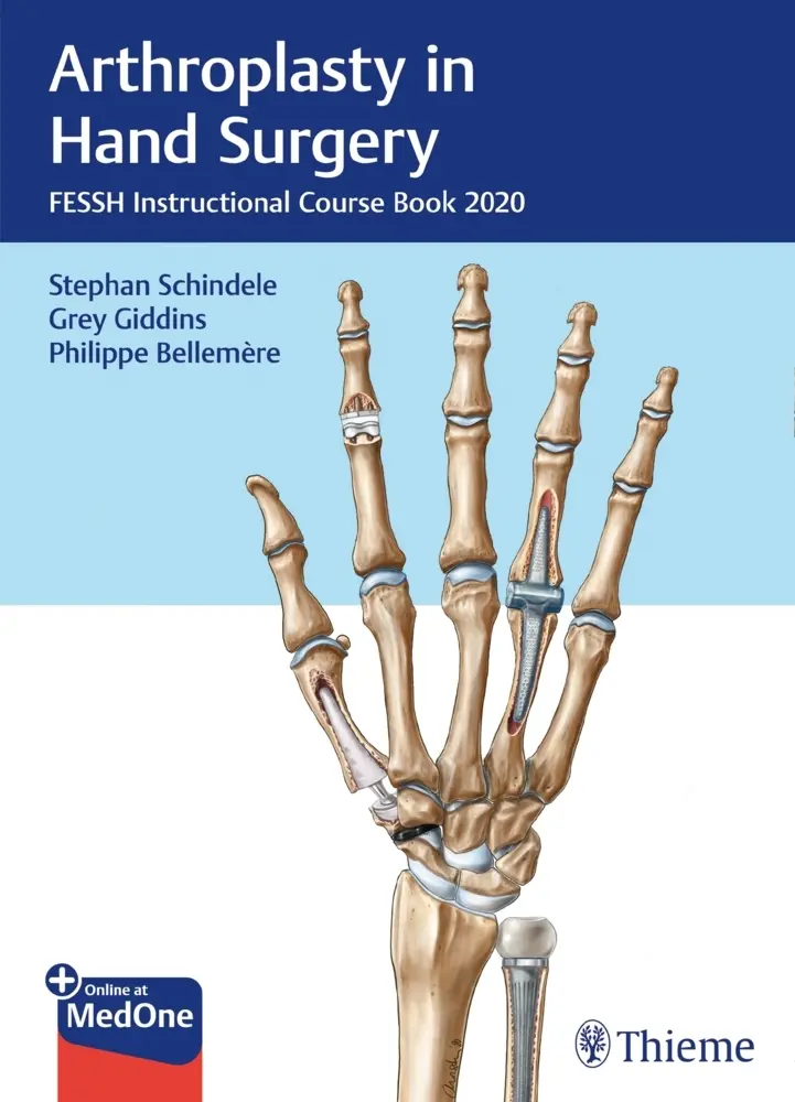 Cover: 9783132431744 | Arthroplasty in Hand Surgery | Stephan Schindele (u. a.) | Bundle