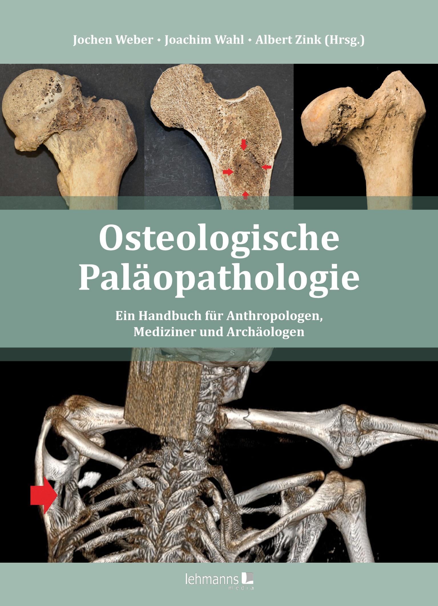 Cover: 9783965433144 | Osteologische Paläopathologie | Jochen Weber (u. a.) | Buch | 688 S.