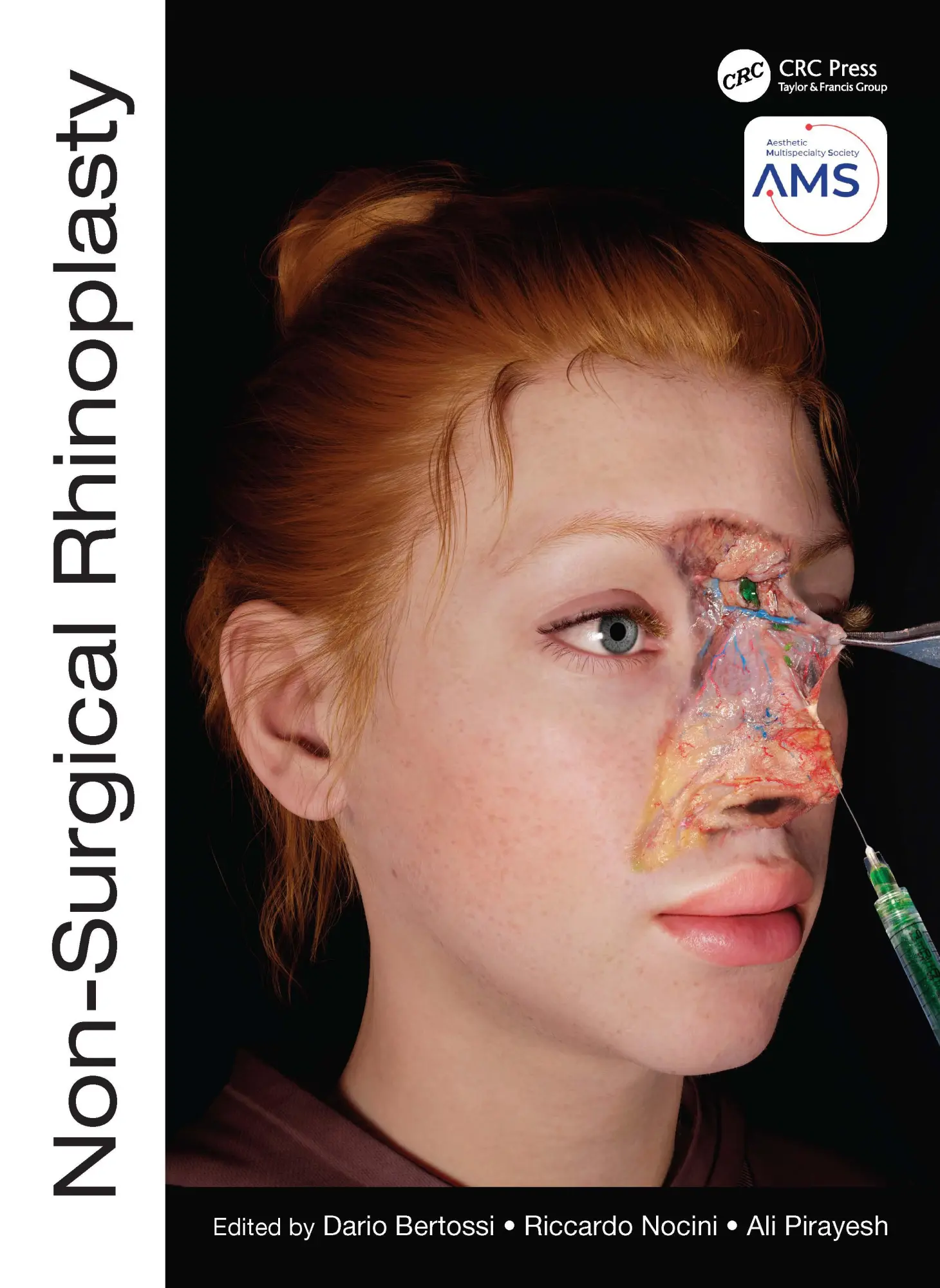 Cover: 9781032303444 | Non-Surgical Rhinoplasty | Dario Bertossi (u. a.) | Buch | Englisch
