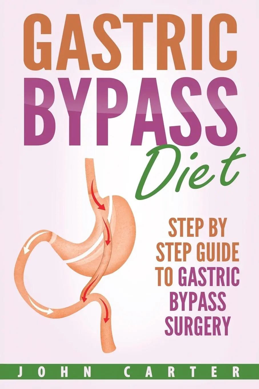 Cover: 9781951103644 | Gastric Bypass Diet | Step By Step Guide to Gastric Bypass Surgery