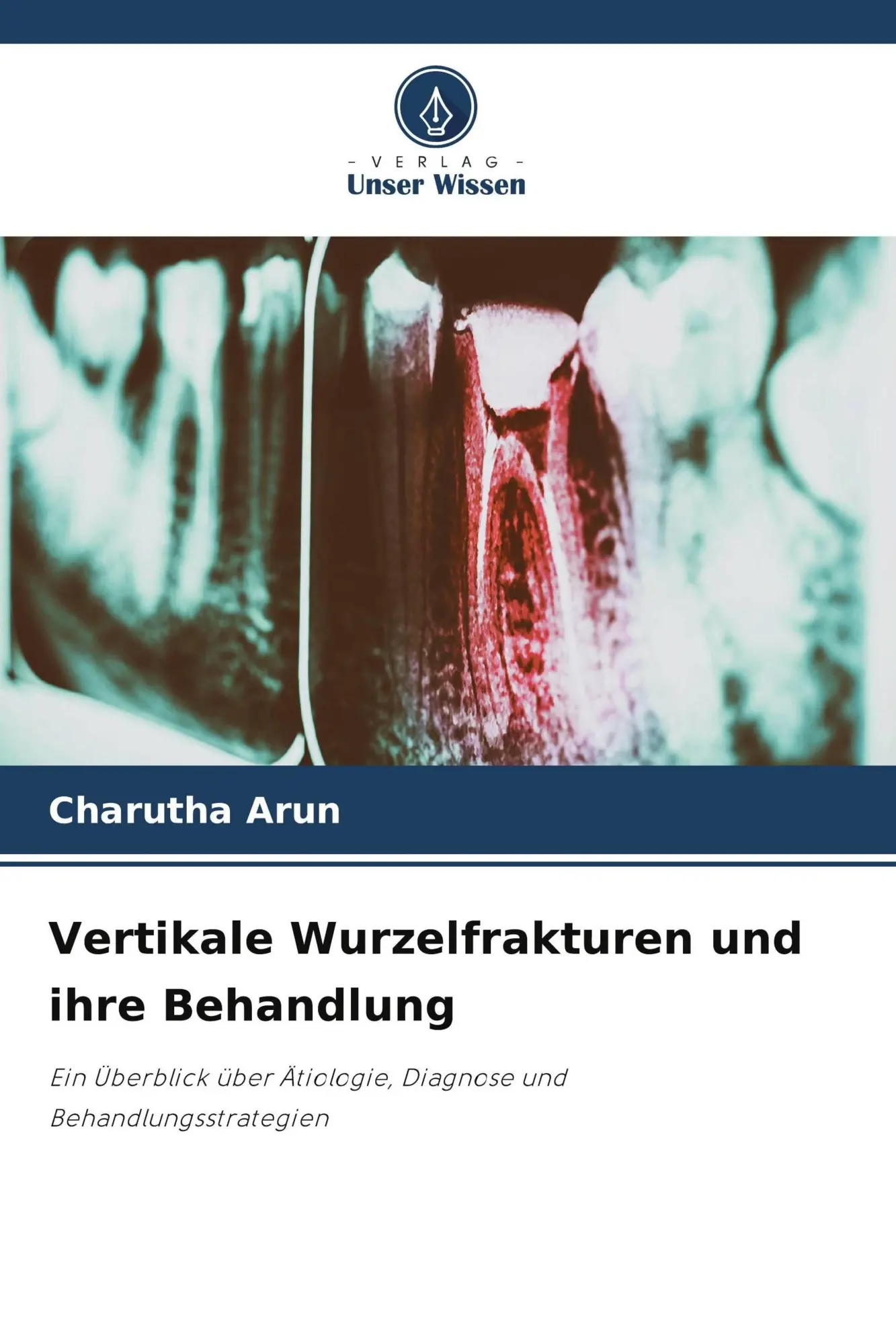 Cover: 9786209564444 | Vertikale Wurzelfrakturen und ihre Behandlung | Charutha Arun | Buch
