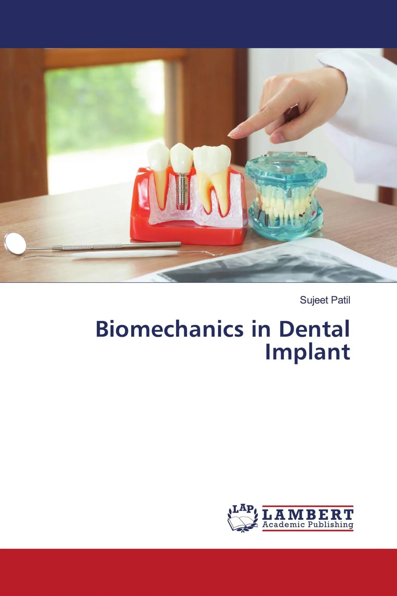 Cover: 9786208446444 | Biomechanics in Dental Implant | Sujeet Patil | Taschenbuch | Englisch