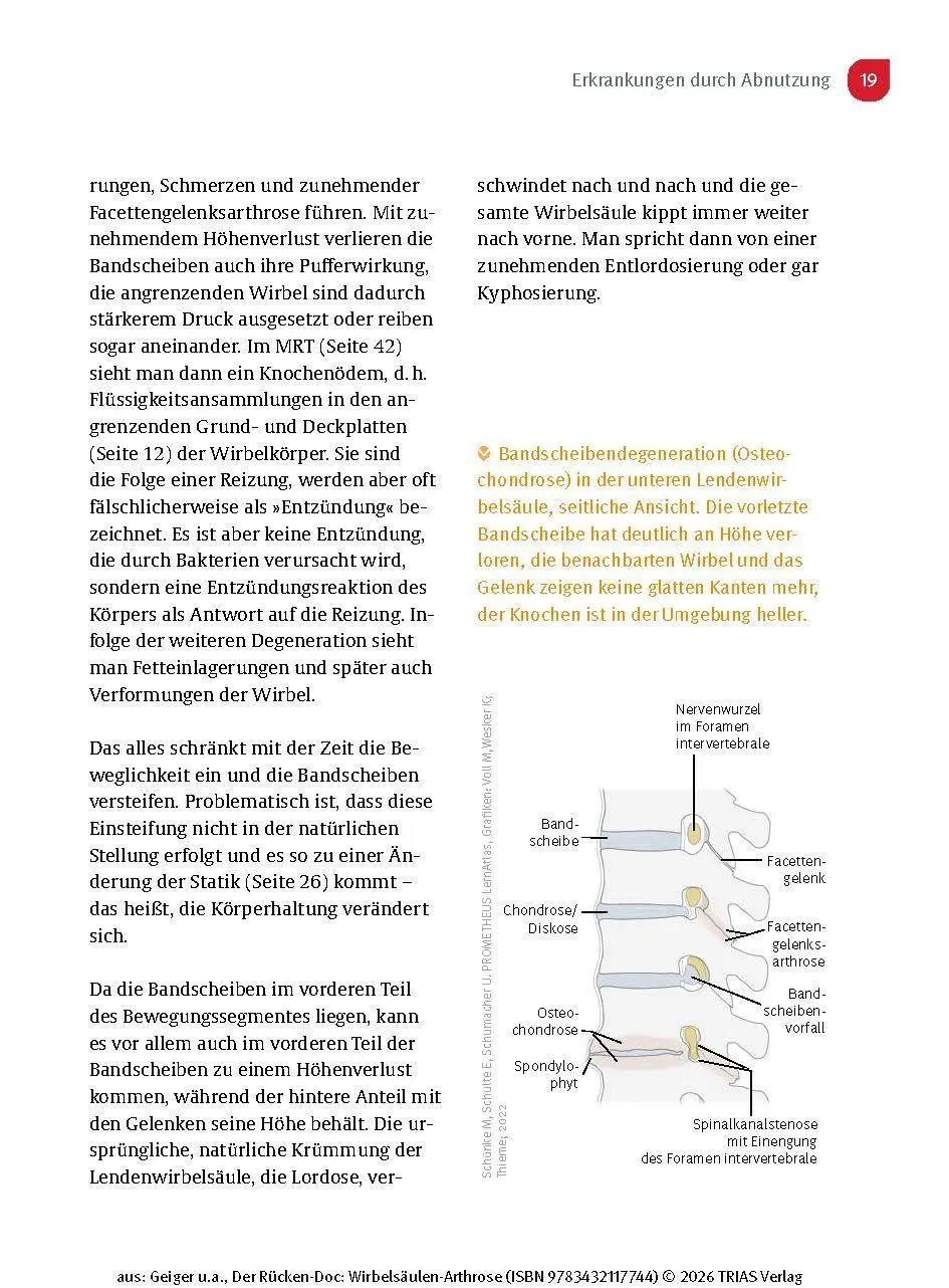 Bild: 9783432117744 | Der Rücken-Doc: Wirbelsäulen-Arthrose | Florian Geiger (u. a.) | Buch