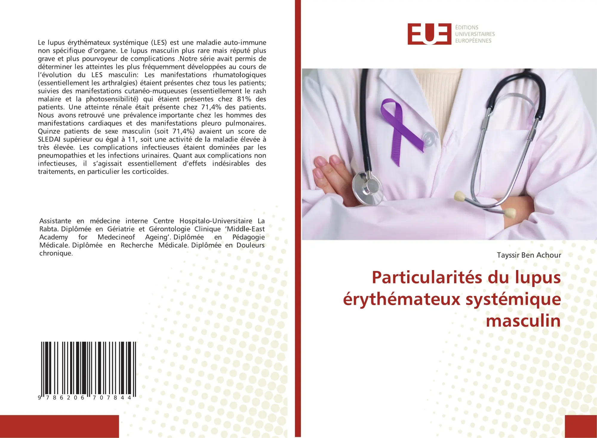 Particularités du lupus érythémateux systémique masculin