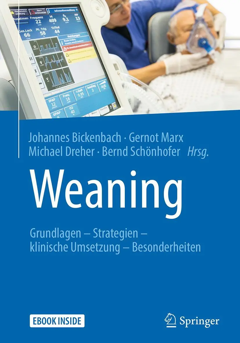 Cover: 9783662497944 | Weaning | Johannes Bickenbach (u. a.) | Taschenbuch | Book + eBook