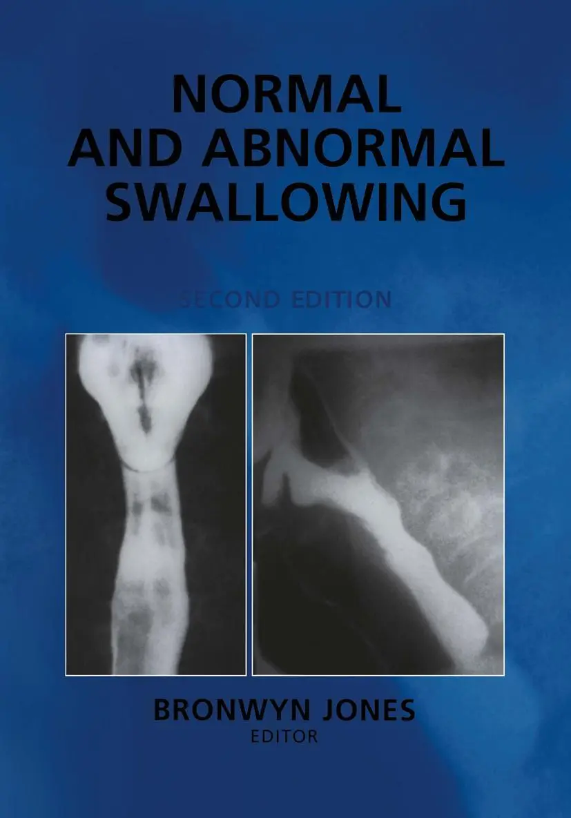 Cover: 9781441929044 | Normal and Abnormal Swallowing | Imaging in Diagnosis and Therapy