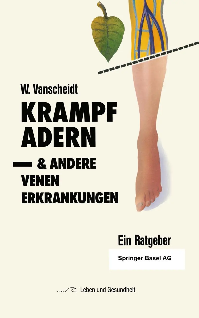 Cover: 9783764319144 | Krampfadern und andere Venenerkrankungen | Ein Ratgeber | Vanscheidt