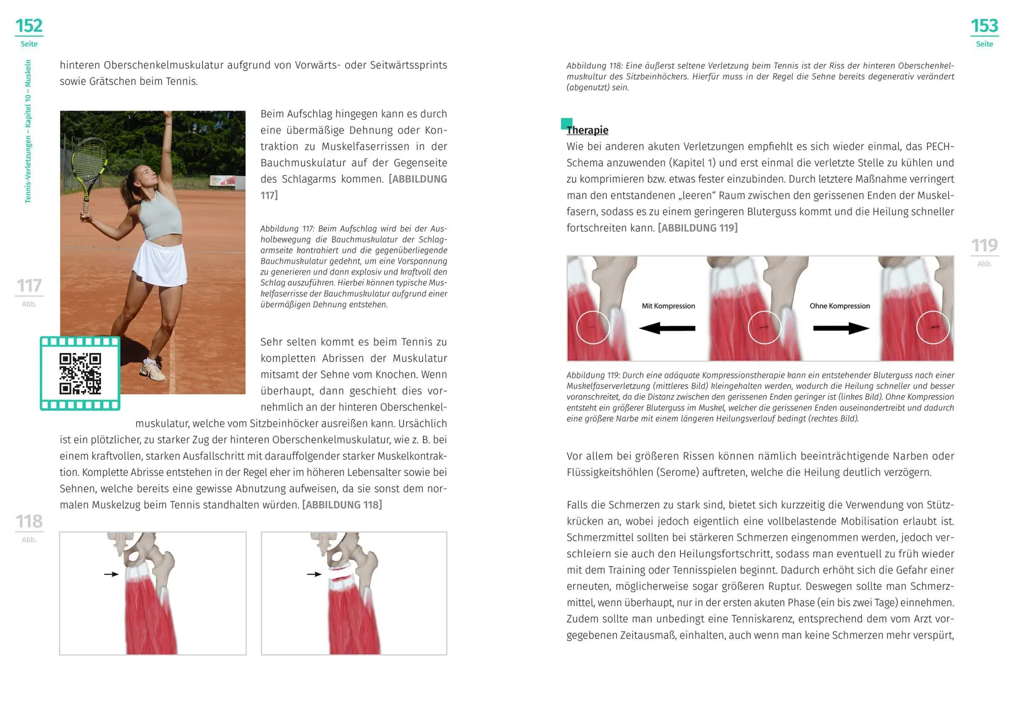 Bild: 9783964160645 | Tennis-Verletzungen | Peter Kaiser | Taschenbuch | 152 S. | Deutsch