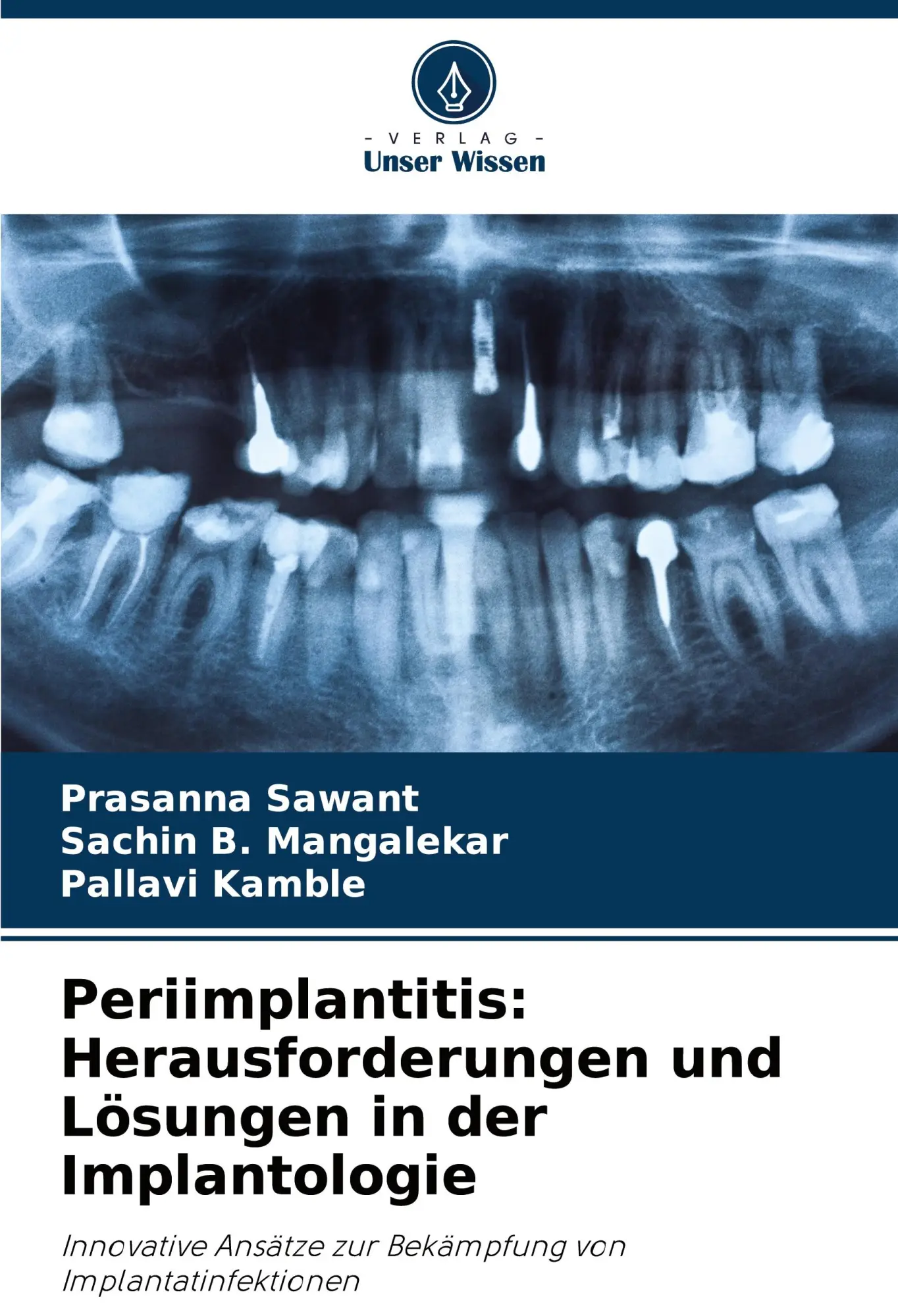 Cover: 9786208611545 | Periimplantitis: Herausforderungen und Lösungen in der Implantologie