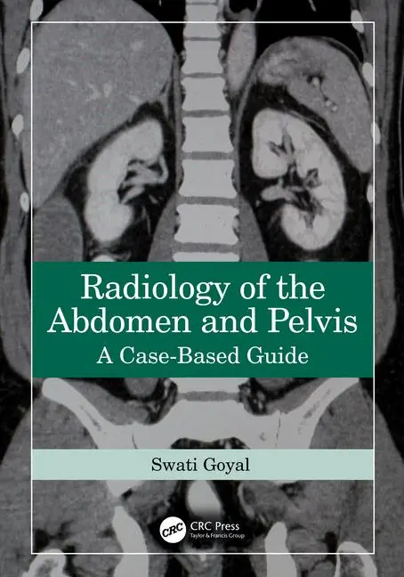 Cover: 9781032587745 | Radiology of the Abdomen and Pelvis | A Case-Based Guide | Swati Goyal
